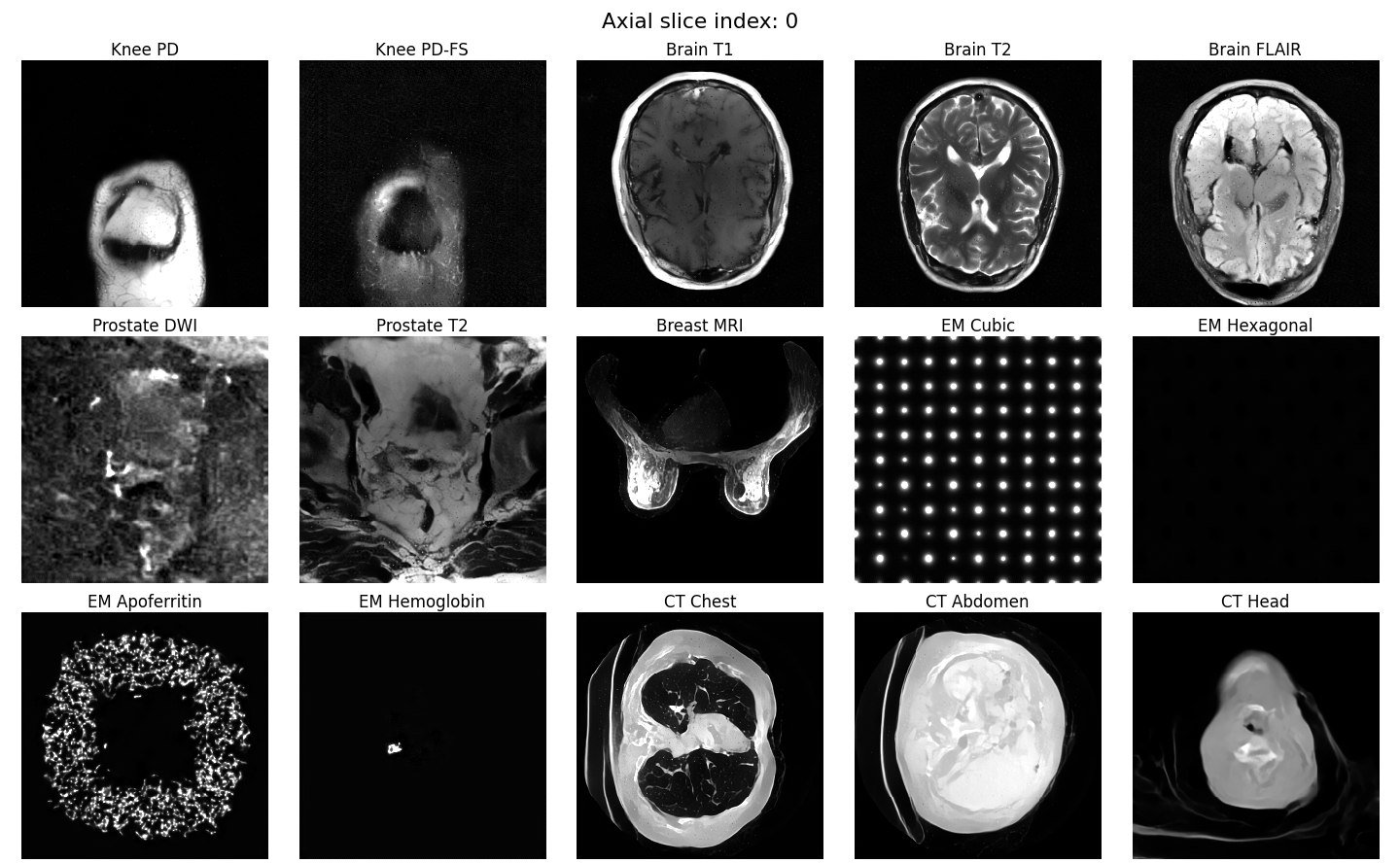 Animated generated volumes across all 15 imaging modalities in a 3-by-5 grid