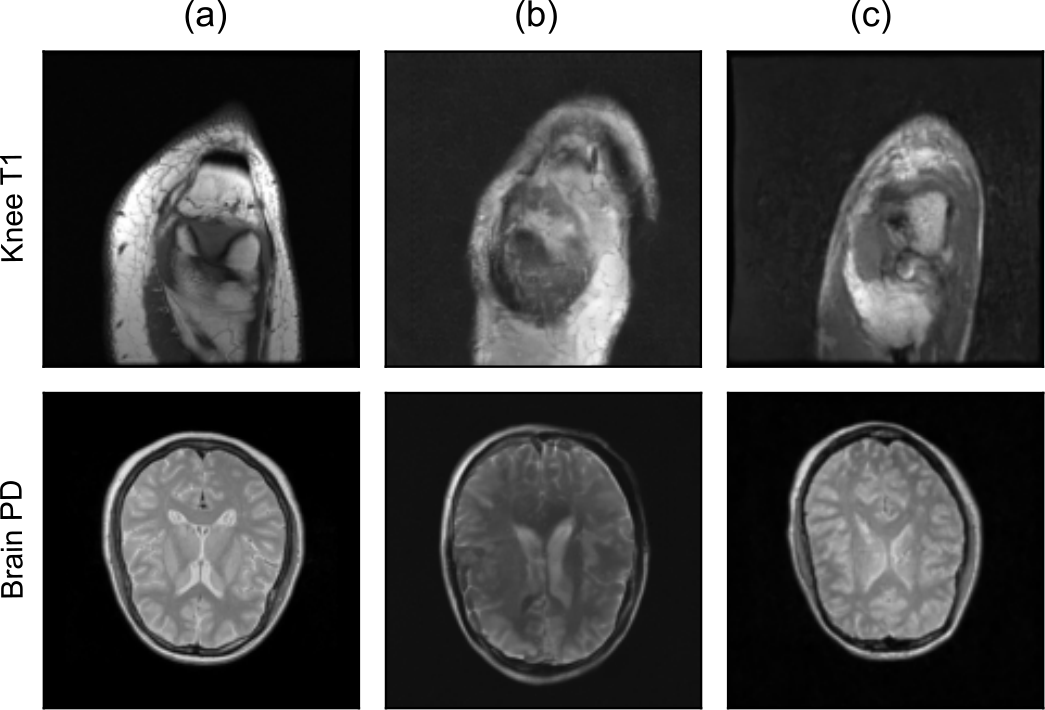 Zero-shot comparison for knee T1 and brain PD